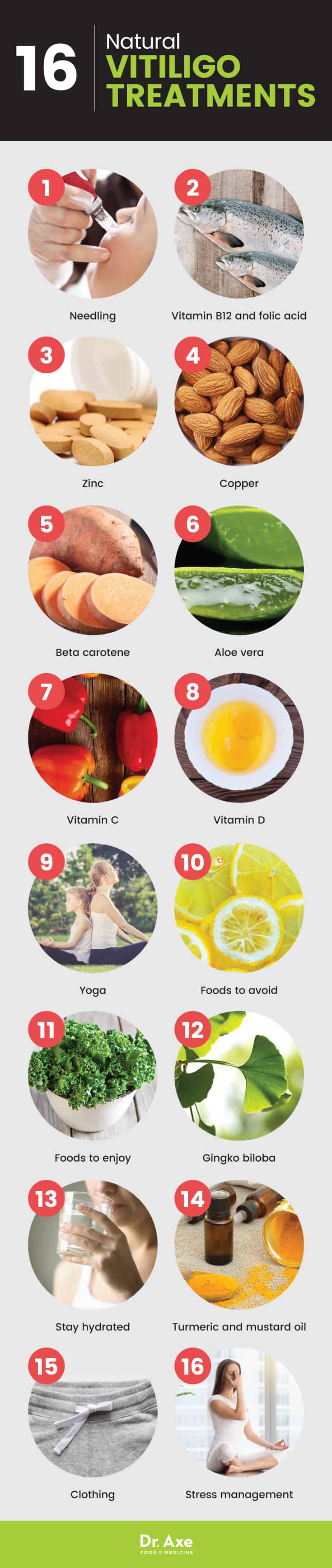 白癜风治疗：改善色素沉着的16种自然方法